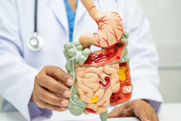 Alimentación y Salud Intestinal: La Clave de una Nutrición Funcional y un Microbioma Sano